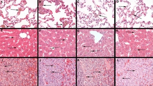 Figure 6 Histology of the lungs, liver, and spleen of a rat post injection of SPION microbubbles. Abundant intravascular, fibrin-covered microbubbles in lung at 10 minutes (A) and 24 hours (B). A decreased number of phagocytosed microbubbles were observed at 2 weeks (C). Iron pigment becomes apparent in macrophage cytoplasm after 4 weeks (D). In the liver, rare microbubbles are found in the vicinity of Kupffer cells at 10 minutes post injection (E), and increasingly phagocytosed at 24 hours (F). Phagocytosed microbubbles were abundant at 2 weeks post injection (G) and decreased 4 weeks after injection (H). In the spleen, 10 minutes after injection, microbubbles are found in red pulp and marginal zone (I). From 24 hours after injection and onwards, the microbubbles are associated with marginal zone macrophages and rare in red pulp (J). (K) at 2 weeks and (L) at 4 weeks. The size bar represents 10 μm. The arrows show the microbubbles in the different tissues.Abbreviation: SPION, superparamagnetic iron oxide.
