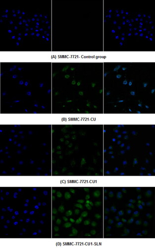 Figure 8. Drug distribution in SMMC-7721 cells. (A) Control group, (B) CU, (C) CU1, and (D) CU1-SLN.