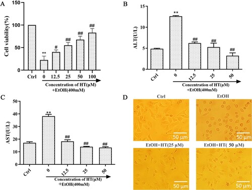Figure 1. Effects of HT on liver injury in ethanol-induced HepG2 cells. HepG2 cells were treated with 400 mM ethanol together with different concentrations of HT. (A) The cell survival rate of HepG2 cells was measured by MTT assay. (B, C) The levels of intracellular ALT and AST were measured. (D) Status of HepG2 cells were observed under the microscope. The data represented as mean ± SD and difference between groups are considered significant at P < 0.05. * Difference to the Ctrl group. # Difference to the EtOH group.