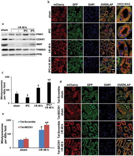 Figure 5. Both renal IPC and Tat-BECN1 preconditioning enhance mitophagy in proximal tubules during subsequent renal IRI in mice. (a) C57BL/6 mice were subjected to: (1) sham (n = 3); (2) I-R (n = 7); (3) IPC + I-R (n = 10). Kidneys were collected for immunoblot analysis of PINK1, COX4I1, IMMT/MIC60, and TOMM20. PPIB (peptidylprolyl isomerase B) was used as a loading control. Mito-QC mice were subjected to: (1) sham (n = 3); (2) IPC (n = 3); (3) I-R (n = 4); (4) IPC + I-R (n = 5). Kidneys were collected to determine mitophagy flux by fluorescence microscopy. (b) Representative images of the formation of mitolysosomes. Scale bar: 20 µm for low magnification and 5 µm for high magnification. (c) Quantitative analysis of the number of mitolysosomes per 400× field (renal cortex and outer stripe of outer medulla, glomeruli excluded). Data are expressed as mean ± SD. *, P < 0.05, significantly different from the sham group; #, P < 0.05, significantly different from I-R group. Furthermore, mito-QC mice were pretreated with Tat-BECN1 and its control peptide (Tat-Scramble) at a single dose of 20 mg/kg i.p. injection. Four h after preconditioning, mice were subjected to sham surgery or 27-min bilateral renal ischemia followed by 48 h of reperfusion (n = 3 for each). Kidneys were collected to determine mitophagy flux by fluorescence microscopy. (d) Representative images of the formation of mitolysosomes. Scale bar: 20 µm. (e) Quantitative analysis of the number of mitolysosomes per 400× field (renal cortex and outer stripe of outer medulla, glomeruli excluded). Data are expressed as mean ± SD. *, P < 0.05, significantly different from the sham group; #, P < 0.05, significantly different from Tat-Scramble + I-R group.