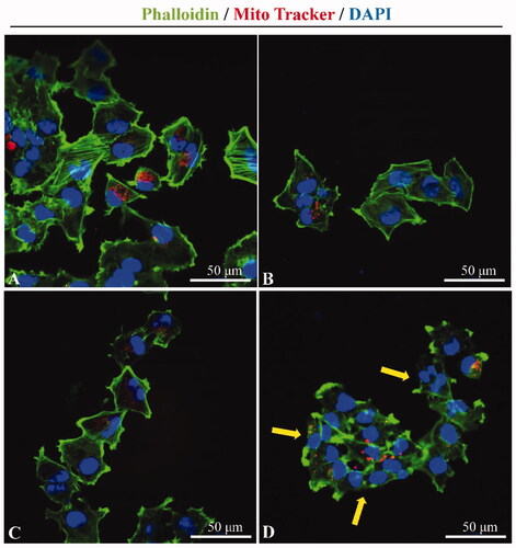 Figure 8. Cytoskeletal changes by ultrasound combined with PSP@MB. Representative confocal microscopy images of Phalloidin (green) labeled F-actin and Mito Tracker (red) labeled mitochondria in A2780 cells after ultrasound exposure. (A) Control group, (B) PSP@MB group, (C) US group, and (D) US + PSP@MB group. The yellow arrow showed that the cytoskeletal disaggregation and the interendothelial junction opening were due to the cavitation generated by ultrasound combined with PSP@MB.