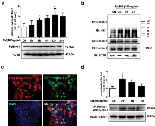 Figure 5. Tat-mediated induction of PELI1/K63-linked ubiquitination of BECN1/Beclin-1.