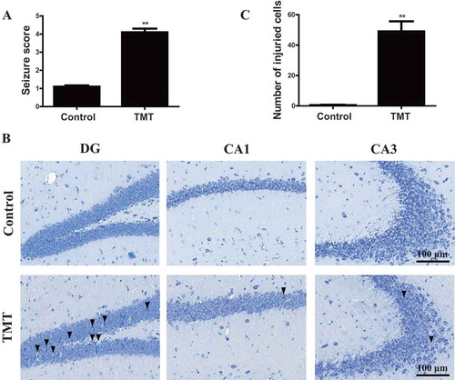 Figure 9. TMT induces neurotoxicity in C57BL/6 J mice. (A) Seizure scores were determined after the mice were administered (i.p.) 2.8 mg/kg TMT for 24 h. We observed 20 mice in each group. The values are presented as means ± SEM. **P <.01 vs. the control group. (B) Nissl staining was performed on mouse brains treated with 2.8 mg/kg TMT for 24 h. The DG, CA1, and CA3 regions of the hippocampus were observed to evaluate TMT neurotoxicity. (▼) labeled in DG exhibited neuronal cell loss, nuclear shrinkage, and many dark staining of neurons. (▼) labeled in CA1 exhibited neuronal cell loss. (▼) labeled in CA3 exhibited loss of Nissl body. We observed 4 mice in each group. All the sections were observed with a 20 × objective. Scale bar: 100 μm. (C) The number of injured cells in the DG, CA1, and CA3 regions of the hippocampus. We used 4 mice to count in each group. The values are presented as means ± SEM. **P< 0.01 vs. the control group
