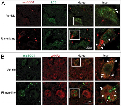 Figure 9. Rilmenidine-induced SOD1 inclusions accumulate outside the autophagy system in motor neurons of SOD1G93A mice. (A) Misfolded SOD1 and LC3 immunohistochemical analysis in lumbar spinal cords of vehicle- and rilmenidine-treated SOD1G93A mice at 90 days of age. Vehicle-treated mice show colocalization of SOD1 and autophagosomes (arrowheads). Large SOD1 aggregates in rilmenidine-treated mice (arrows) do not colocalize with autophagosomes (arrowheads). (B) Misfolded SOD1 and LAMP2 immunohistochemical analysis in lumbar spinal cords of vehicle- and rilmenidine-treated SOD1G93A mice at 90 days of age. Vehicle-treated mice show colocalization of SOD1 and lysosomes (arrowheads). Large SOD1 aggregates in rilmenidine-treated mice (arrows) do not colocalize with lysosomes (arrowheads).