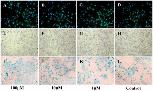 Figure 1. Cell morphology and identification of chondrocytes with different treatments at day 9. (A–D) Type II collagen immunofluorescent identification. (E–H) Crystal violet staining observation. (I–L) Alcian blue staining identification. Bar: 100 μm.