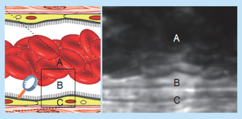 Figure 1.  Blood flow and endothelium interactions in the microcirculation.Shows schematic representation of the CFL and the RBC core and how it is visualized in vivo using intravital microscopy. (A) RBC core, (B) CFL and (C) endothelial lining.