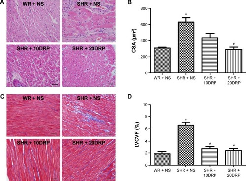 Figure 4 DRPs improve left ventricular hypertrophy and myocardial fibrosis.Notes: (A) Representative micrographs of cross sections of LV cardiomyocytes of each group. Scale bars: 50 μm. (B) Quantitative analysis of the CSA of LV cardiomyocytes. (C) Representative images of LV with Masson’s trichrome stain of each group. (D) Quantitative analysis of LVCVF. Values are mean ± SEM, n=3 per group, *P<0.05 compared with WR + NS and #P<0.05 compared with SHR + NS. Scale bars: 50 μm.Abbreviations: DRP, drag-reducing polymer; LV, left ventricle; CSA, cross-sectional area; LVCVF, collagen volume fraction in left ventricle; SEM, standard error of the mean; WR, Wistar rats; NS, normal saline; SHR, spontaneously hypertensive rats.