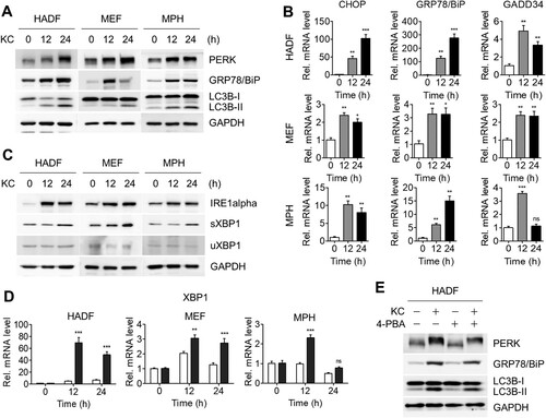 Figure 2. KC-induced autophagy by ER stress-mediated UPR signaling. (A) KC induces ER stress-mediated UPR. The phosphorylation of PERK, the UPR sensor protein, can be observed through the shift of PERK band. GRP78/BiP is the master regulator of UPR. (B) Increased level of IRE1alpha, an ER-localized transmembrane protein and endonuclease, and XBP1 splicing by IRE1alpha were identified. sXBP1, spliced form of XBP1, uXBP1, unspliced form of XBP1. (C) HADF, MEF, and MPH cells were treated with KC for the indicated time (0, 12, or 24 h) and mRNA levels of uXBP1 and sXBP1 were determined using qRT-PCR. (D) mRNA levels of CHOP, GRP78/BiP, and GADD34 were analyzed by qRT-PCR using the specific primers. All data in bar graphs represent the mean value from three independent experiments. *p < 0.05; **p < 0.01; ***p < 0.001. ns, not significant. (E) HADF cells were treated with either KC (20 µM), 4-PBA (2.5 mM) alone for 16 h, or pre-treated with 4-PBA 4 h before the treatment with KC, and diminished levels of ER stress marker proteins were measured by immunoblotting.