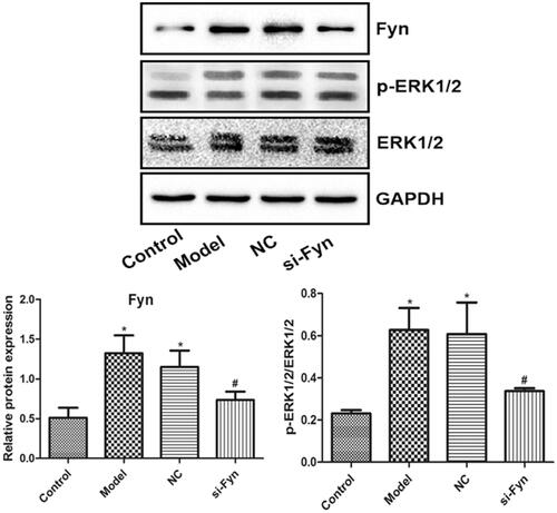 Figure 5. The expression of Fyn, ERK1/2 and p-ERK1/2 in OLs of various groups which was evaluated by western blot. Normal cultured cells served as the Control. In the Model group, cells were cultured in Mg-free extracellular fluid for 3 h and then cultured in the original medium. In the NC group, cells were transfected with Fyn siRNA NC and then modeled. In the si-Fyn group, cells were transfected with Fyn siRNA and then modeled. *p < .05 vs. Control; #p < .05 vs. Model.