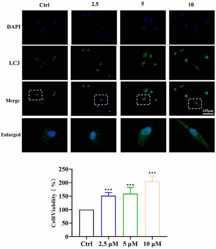 Figure 6. ICA induce LC3B expression in EA.hy926 cells. After treated by 2.5, 5 and 10 μM of ICA for 6 h, the level of LC3B was detected by immunofluorescence