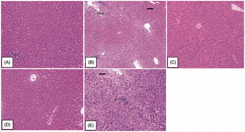 Figure 2. Hepatoprotective effect of MSE in CCl4-intoxicated mice. (A) Group I (normal control): showing normal hepatic architecture and normal hepatocytes. (B) Group II (CCl4 only): showing marked loss of hepatic architecture, central vein congestion, hydropic degeneration, scattered lymphocytes in between the hepatocytes and spotty necrosis in the sinusoids. (C and D) Groups III and IV (CCl4 + 500 mg/kg or CCl4 + 1000 mg/kg, respectively, of MSE): showing intact hepatic architecture and normal hepatocytes. (E) Group V (CCl4 + 500 mg/kg of silymarin): showing normal hepatic architecture and mild hydropic degeneration of hepatocytes, with moderate scattered lymphocytes in between the hepatocytes and in the sinusoids (H&E, 200×). Hydropic degeneration Display full size, central vein congestion Display full size, scattered lymphocytes in between the hepatocytes and in the sinusoids Display full size.
