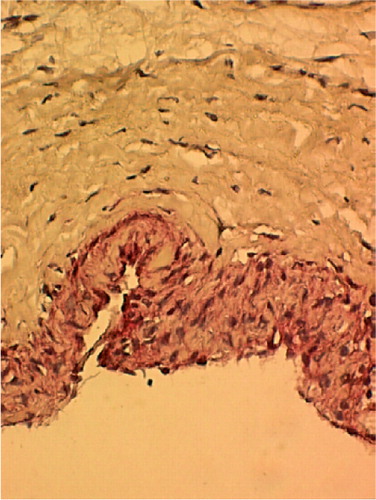 Figure 7. Histology of freshly harvested periosteum stained using alkaline phosphatase histochemical assay, with hematoxylin counterstaining. The cambium layer shows a high level of alkaline phosphatase activity (shown by red color), whereas the fibrous layer shows negligible alkaline phosphatase activity (400 ×).