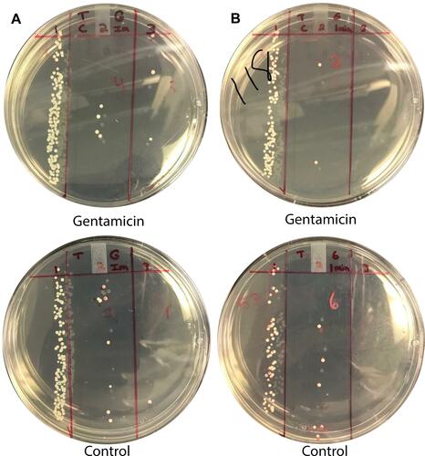 Figure 1 Gentamicin Soak Decreases S. aureus Bacterial Load on Silicone Sponges. Silicon sponges inoculated with S. aureus broth were dipped into 1 mg/mL gentamicin solution or control solution for a duration of 1 second (A) or 1 minute (B). The left column on each plate represents undiluted sample. The middle and right column represent serially diluted samples. Fewer colonies were identified in sponges soaked with gentamicin relative to control, at all soaking durations.