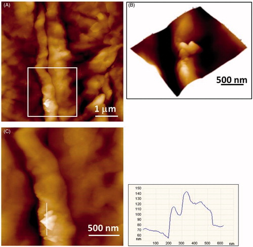 Figure 6. AFM imaging of the 15th SC tape of a healthy subject revealing cluster of nanoparticles: (A) height image with vertical scale of 400 nm; (B) 3D view of zoomed area (white box in A); (C) height image of zoomed area in A with height profile of the cluster along indicated line.