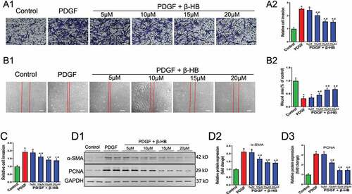 Figure 2. β-hydroxybutyrate attenuates vascular smooth muscle cell migration and proliferation stimulated by platelet-derived growth factor. Rat vascular smooth muscle cells (VSMCs) were treated with platelet-derived growth factor (PDGF, 25 ng/mL) or combination of PDGF with various dose of β-hydroxybutyrate (β-HB; 5 μM, 10 μM, 15 μM, 20 μM) for 24 h. (a) Cell migration was measured by the modified Boyden chamber assay after stimulation with PDGF. Representative images of migrated cells (A1) were shown and relative cell invasion numbers were calculated (A2). Scale bars = 20 μM. N = 4. (b) Monolayer confluent cells were growth arrested and scraped in the presence of PDGF to stimulate VSMC migration toward the wound area. Representative images of cell migration were shown and relative wound areas were calculated (B2). Scale bars = 50 μM. N = 4. (c) The cell proliferation was measured using Cell Counting Kit-8 after stimulation with PDGF for indicated periods. N = 4. (d) Protein expressions of α-SMA and PCNA in VSMC were examined by western blot analysis after stimulation with PDGF. Representative blots (D1) and quantification of α-SMA (D2) and PCNA (D3) protein expression were shown. N = 4. Data are expressed as means ± SD. *p < .05 vs. control; #p <.05 vs. PDGF.