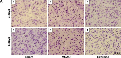 Figure 3 Exercise prevented neuronal cell death in rat model of ischemic brain injury.