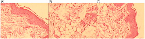Figure 5. Histopathological image of (A) Control (B) formalin treated (C) TRM loaded nanoethosomal gel (400×).