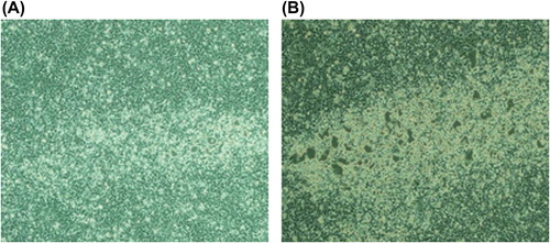 Figure 3. Viral packaging map after HEK293A cells were transfected with the adenoviral vector (× 40). (A–B) After HEK293A cells were transfected with VEGF165 adenoviral vectors and empty adenoviral vectors, similar cytopathic effects were found in the two groups.