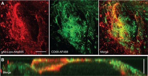 Figure 3 Costaining for anti-CD68. Aortic sections of apolipoprotein E-deficient mice were incubated with Atto655-labeled gAd-coupled stealth liposomes and costained with an Alexa Fluor 488 ready-labeled mouse anti-CD68 antibody. A) Three-dimensional fluorescence images from an atherosclerotic plaque. Bar indicates 50 μm. B) Vertical fluorescence image of the same plaque. Vertical bar indicates 15 μm. The yellow signal in the merged images indicates the colocalization of gAd liposomes (red signal) and anti-CD68 (green signal).Abbreviation: gAd, globular domain of adiponectin.