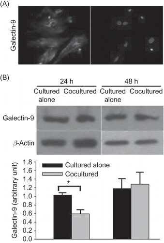 Figure 5 Galectin-9 expression in rat renal interstitial fibroblasts. (A) Immunofluorescence analysis of galectin-9 expressed in rat renal interstitial fibroblasts (400× magnification). (B) Western blot analysis of galectin-9 expression in rat renal interstitial fibroblasts cultured alone and those cocultured with CD4 T lymphocytes for 24 or 48 h (n = 5). Data were expressed as mean ± SD.Note: *p < 0.01 for data of the cocultured fibroblasts compared with the cultured alone.