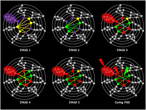 Figure 1. A 5-stages GNW-based model of FND, and of therapeutic interventions.Legend: Hierarchy of connections between brain processors is symbolised by concentric dotted circles (after (Dehaene et al. Citation1998; Dehaene and Naccache Citation2001) and (Mesulam Citation1998)). Each cortical processor is symbolised by a full disc. Higher levels of this hierarchy (i.e.: the most inner circle) are assumed to be widely interconnected by long-distance interconnections, thus forming a global neuronal workspace. An amplified state of workspace activity, bringing together several peripheral processors in a coherent brain-scale activation pattern (coloured ellipses), can coexist with the automatic activation of multiple local chains of processors outside the workspace (gray circles).STAGE 1: Conscious access to an emotionally traumatic conscious feeling (for all coloured texts, see corresponding coloured components in the figure)STAGE 2: Post-experiential voluntary & conscious process: « I would like to forget this feeling »STAGE 3: Unvoluntary efficient inhibition of specific relevant networks through conscious influences on unconscious processes & through GNW-MurmurSTAGE 4: Conscious access to unvoluntary FND symptoms: « I can’t remember this period »STAGE 5: Persistence of FND symptoms as long as Stage-2 and Stage-3 processes are actively maintained in GNW activity.Curing FND: Targeting current symptoms (e.g.: C.B.T.) would act on stage-3 processes, whereas interventions (represented in the figure by coloured lightning symbols) targeting introspection of subjective interpretation of FND would act on stage-2 (e.g.: self-narrative and interpretative psychoterapies).