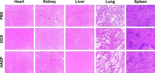 Figure 9 Histological analysis of organs excised from mice that received PBS, DOX, or the HADP injections.Abbreviations: AuNR, gold nanorod; DOX, doxorubicin; HADP, HSA/AuNR/DOX–PLGA; HSA, human serum albumin; PLGA, poly(lactic-co-glycolic acid).