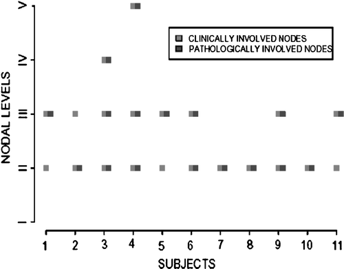 Figure 1.  The clinical and pathological nodal level(s) involved in patients with positive neck dissections revealing pathologic positively always within the clinically involved nodes.