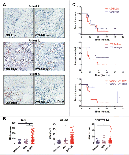 Figure 1. CD8+/CTLA4 protein expression ratio is high in HNSCC and correlated with prognosis. (A) Immunohistochemical analysis of CD8+ and CTLA4 protein expression in HNSCC. Representative pictures are presented at different staining intensities (Low and High). Scale bar, 100 μm. (B) Quantification of CD8+, CTLA4 and CD8+/CTLA4 ratio protein expression histoscore in oral mucosa, dysplasia (Dys), and head neck squamous cell carcinoma (HNSCC). (Graph Pad One way ANOVA with post Tukey test. *p < 0.05; **p < 0.01; ***p < 0.001). (C) Kaplan–Meier survival analysis by CD8+, CTLA4 and CD8+/CTLA4 ratio in HNSCC patients (*p < 0.05).