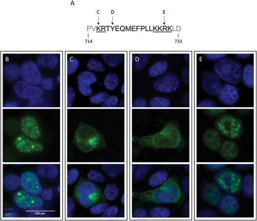 Figure 1. Nuclear import of ADNP is impaired upon mutagenesis of its NLS sequence.Cell localization studies in HEK293T cells using an expression vector of human ADNP, carrying a N-terminal eGFP-tag. The GFP signal (green) is indicative of ADNP expression and localization. The cell nucleus was visualized using DAPI (blue). (a) The modeled mutations positioned on the ADNP bipartite NLS sequence. The NLS basic amino acid regions are underlined and separated by the central spacer sequence. (b) Expression of wild-type ADNP is restricted to the nucleus. (c) Mutation p.Lys716Glu, affecting the first basic region of the ADNP NLS, causes the mutant ADNP protein to stall in the cytoplasm. (d) Introduction of the common p.Tyr719* mutation presents cytoplasmic mislocalization like the previous mutation. (e) p.Arg730* transcripts are imported in the nucleus.