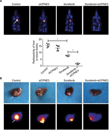 Figure 7 Silencing copine-III enhances the effect of sorafenib on MHCC97-H cell intrahepatic growth.Notes: MHCC97-H cells, which were injected with control siRNA or siCPNE3, were injected into liver lobes to form intrahepatic nodules. Next, nude mice were treated with a solvent control or sorafenib. After 4–6 weeks of growth, tumor nodules formed by MHCC97-H cells in liver organs were examined by positron emission tomography (PET)/CT scanning. (A) Results showed the PET/CT images of whole animals or radioactivation of liver to blood; (B) images of tumor modules or PET/CT results from the liver. *P<0.05.