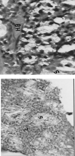 FIG. 3A Representative photomicrograph of thymus recovered from rats on Day 22 of the respective indicated treatment regimens (L = Lymphocytes, S = Sinusoid, HB = Hassel's Body. Left image at 10×, Right image at 40×.