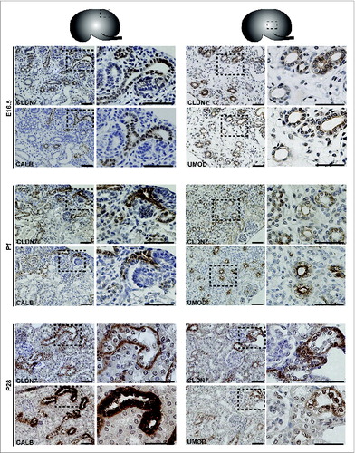 Figure 3. Protein Expression of Claudin-7 during Mouse Kidney Development. Immunohistochemistry was performed on paraffin-embedded sections taken from mouse kidneys at embryonic day (E) 16.5, postnatal day (P) 1 and P28 as shown. Claudin-7 is expressed in ureteric bud trunks and tips at E16.5 and in distal tubular segments as well at P1 and P28, based on its overlapping expression with Calbindin-D-28K and with Uromodulin. A higher magnification of the boxed regions are shown to the right of each image. Scale bar = 50 μm.