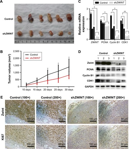 Figure 7 ZWINT knockdown inhibited tumor formation in vivo in nude mice.