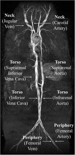 Figure 1. Coronal maximum intensity projection (MIP) [Citation25] illustrating arterial and venous locations where imaging data were acquired and quantified.