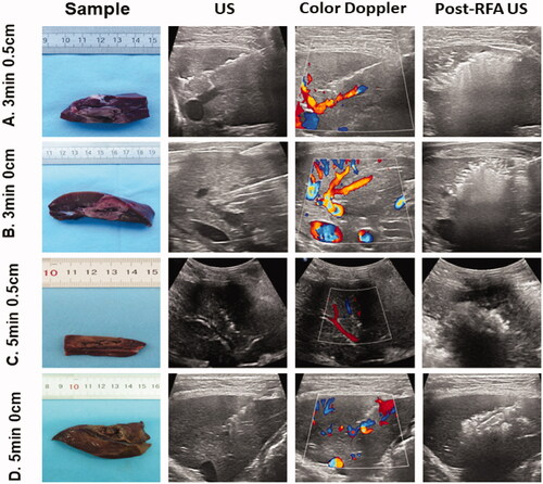 Figure 1. Evaluation of the distance between the radiofrequency ablation (RFA) electrode tip and large vessel, ablation time and specimens/images of different groups. Tissue specimens obtained after euthanizing beagles at 24 h after RFA (first column), conventional ultrasound before RFA (second column), color Doppler ultrasound before RFA (third column) and post-RFA ultrasound (fourth column) are shown. The first row represents a distance of 0.5 cm from the tip of the RFA electrode to a large vessel with the ablation time set at 3 min (3 min 0.5 cm). The second row shows the electrode tip near the large vessel with the ablation time set at 3 min (3 min 0 cm). The third row represents a distance of 0.5 cm from the tip of the RFA electrode to a large vessel with the ablation time set at 5 min (5 min 0.5 cm). The fourth row represents that the electrode tip was near the large vessel with the ablation time set at 5 min (5 min 0 cm).