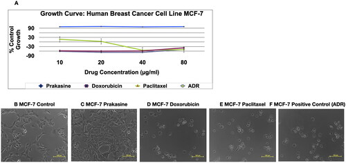 Figure 3. Non-cytolytic anti-Cancer activity and non-cytotoxicity of Prakasine by SBR assay. A, and C indicate that Prakasine does not have cytolytic anti-cancer activity and cytotoxicity in MCF-7 cell line culture as there is a 100% cell growth. The B is the control, The C, D, E and F are Prakasine, Doxorubicin, Paclitaxel and Positive control, ADR. The ADR is the ACTREC’s positive control as per institute protocols. The percentages of cell growth are 100%, −38%, −50% and −49% in Prakasine, Doxorubicin, Paclitaxel and positive control, ADR respectively compared with control. ADR: Adriamycin, ACTREC : Advanced Centre for Treatment, Research & Education in Cancer