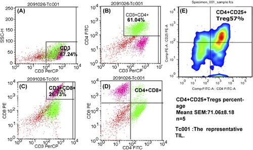 Figure 2. Flow cytometry for TILs. Figure A–D showed the representative results of TILs by FCM. A total of 87.24% cells were CD3+ T lymphocytes. Among the TILs, CD3+ CD4+ T lymphocytes reached 61.04% and CD3+ CD8+ T lymphocytes accounted for 26.73%. (F) The minimum percentage of CD4+ CD25+ Tregs from one sample (accompanied by CD127low, not shown) reached 57%, and the five samples reached as high as 71.06% ± 8.18%. All TILs were obtained from patients suffering from invasive breast cancer.