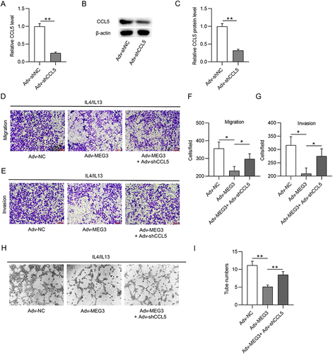 Figure 8 CCL5 depletion reverses the suppressive effect of Adv-MEG3 on HCC malignant cell behavior. (A–C) RT-qPCR and Western blot were conducted to quantify CCL5 mRNA and protein levels in M2-like macrophages transfected with Adv-shCCL5 or Adv-shNC. (D–G) Transwell assays were carried out for measurement of cell migration and invasion in Adv-NC, Adv-MEG3, and Adv-MEG3+ Adv-shCCL5 groups. (H and I) Tube formation assays were conducted to explore the influence of MEG3 and/or CCL5 on angiogenesis in the context of M2-like macrophage polarization. *p<0.05, **p<0.01.