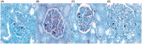 Figures 4. Caspas-3 IHC staining. Imunolocalization of caspas-3 (F) positive mesangial cells, examined under light microscopy, from renal cortex. (A) Control group. (B) OVX group. (C) Ovx + bortezomib group. (D) OVX +17β-estradiol group. Original magnification × 40.