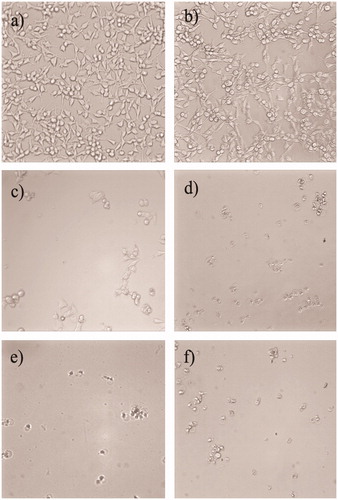 Figure 7. Morphological changes in A375 cells. (a) Control without irradiation, cells in EtOH 70% (0.5%, v/v), without sample; (b) control upon irradiation (365 nm, a dose of 1.08 J/cm2); (c) H. perforatum no. 1, 100 μg/mL upon irradiation; (d) H. perforatum no. 2, 100 μg/mL upon irradiation; (e) H. perforatum no. 3, 100 μg/mL upon irradiation; (f) H. perforatum no. 4, 100 μg/mL upon irradiation.