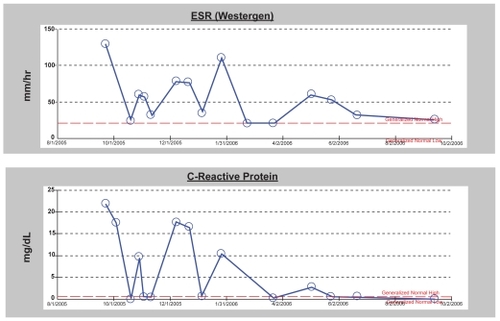 Figure 4 Graphs of sed rate and c-reative protein in patient with serum-sickness like syndrome following immunotherapy with ibritumomab aand rituximab. The rise in inflammatory markers corresponded with attempts at tapering of the dose of steroid.