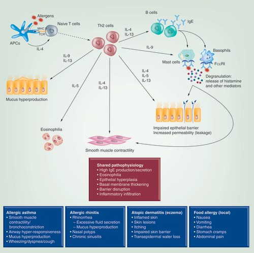 Figure 1. Allergic (type 2) inflammation: basic mechanisms and pathophysiology, and selected clinical consequences.Th2 cytokines can be synthesized also by innate lymphoid cells type 2 (ILC2), which is not shown. Contribution of Th9 cells, major IL-9 producers, is also not presented. MHC-II denotes MHC class II molecules; TCR, T cell receptor. For remaining abbreviations, detailed description of the figure content and additional information, please, refer to the main text. This figure was inspired by several previously published images, especially by the one by Gandhi et al. [Citation23].