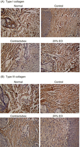 Figure 1.  Immunohistochemical findings. (A) Type I collagen. (B) Type III collagen. Immunohistochemical reactivities of collagens I and III were found in the rabbit ear scars. The control group showed the more areas and higher densities of collagens I and III, and 20% essential oil (EO) group exhibited the fewer areas and lower densities than the control group. Figures for groups given doses of 5 and 10% EO were not shown.