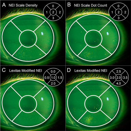 Figure 2 Reference illustrations provided to the independent examiners as examples for each grade level of the (A) original NEI density, (B) structured NEI dot count, (C) Lexitas modified NEI (score range 0.0–2.0), and (D) Lexitas modified NEI (score 2.0–4.0) staining scales.