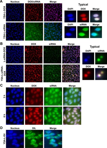 Figure 6 Intracellular delivery of siRNA and DOX.Notes: Typical images of SaOs-2 human osteosarcoma cells incubated with YSA-L-siRNA, YSA-L-DOX, and YSA-L-siRNA-DOX. siRNA is labeled with green fluorescent FAM, and DOX is labeled with intrinsic red fluorescent. Nuclei were stained with DAPI (blue fluorescence). Nuclear uptake of DOX and siRNA gives pink and cyan colors, respectively. Colocalization of DOX and siRNA tends to be white, representing nuclear uptake of both compounds. (A) Localization of YSA-L-siRNA and YSA-L-DOX. Magnification right (“typical”) panel: 500×. B right (“typical”) panel: 200× C and D; 500× (B) Comparison between cellular uptake of targeted and nontargeted formulations. Magnification right (“typical”) panel: 200×. (C) Time-dependent cellular uptake of YSA-L-siRNA-DOX. Magnification 500×. (D) Assessment of “plain” liposomal uptake; liposome vesicles were stained with DiI (which also gave a brilliant signal in the green channel). The brilliant cyan after superposition of the DAPI and DiI images shows clear intracellular uptake of the labeled vesicles. Magnification 500×.Abbreviations: DAPI, 6,4-diamidino-2-phenylindole; DIL, tetramethylindocarbocyanine perchlorate; DOX, doxorubicin.