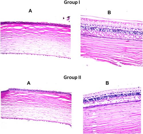 Figure 7 Photomicrographs showing histopathological sections (hematoxylin and eosin stained) of normal untreated rabbit’s eye (group I) and rabbit’s eye treated with FTN loaded optimized TPs (group II). (A) illustrates histological structure of the cornea and (B) illustrates histological structure of the retina, choroid and sclera.