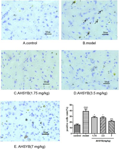 Figure 5. Effect of AHSYB on TLR-4 ptotein expression in cerebral cortex of rats with acute permanent cerebral ischemia by immunohistochemistry staining (n = 6, positive as brown, original magnification 10). ΔΔΔ p < .001 versus control group, *p < .05, ***p < .001 versus model group.