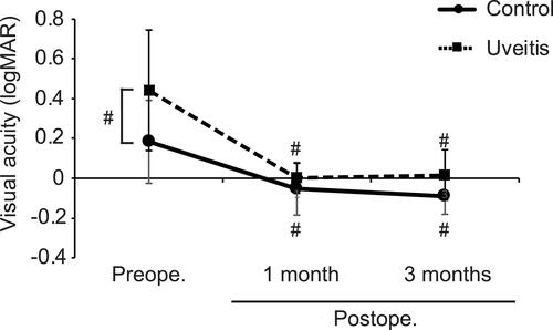 Figure 1 Graphs comparing the mean pre- and postoperative logMAR between uveitis and control groups. The pre- and postoperative best corrected visual acuity for distance converted to logMAR. The mean preoperative logMAR [0.44 ± 0.30, 95% confidence interval (CI): 0.33–0.55] was significantly decreased in the uveitis group than in the control group (0.18 ± 0.21, 95% CI: 0.11–0.26). The mean preoperative logMAR was significantly improved postoperatively at 1 and 3 months in both groups (1 month, control: −0.052 ± 0.13, 95% CI: −0.097–−0.0079; uveitis: 0.025 ± 0.075, 95% CI: −0.037−0.087; 3 months, control: −0.089 ± 0.090, 95% CI: −0.15–−0.029, uveitis: 0.0091 ± 0.13, 95% CI: −0.073–0.091). Error bars represent the standard error (SE). #P < 0.01; Student’s t-test or paired t-test.