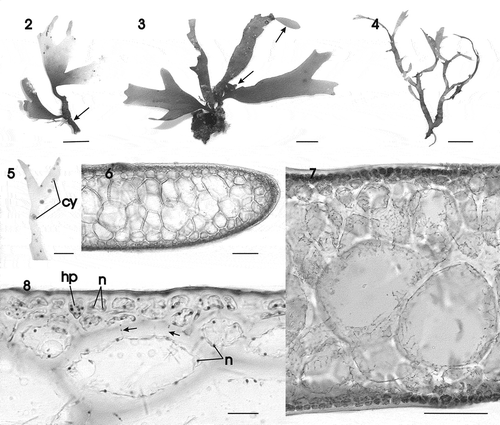 Figs 2–8. Gracilaria corallicola. Habit and vegetative anatomy. Fig. 2. Habit of small erect sterile specimen arising from a long stipe (arrow) (HGI–A 11025). Fig. 3. Adult specimen with spathulate proliferations (arrows) (HGI–A 13122). Fig. 4. Trawled slender specimen (HGI-A 16218). Fig. 5. Detail of branch of a female gametophyte with protruding cystocarps (HGI–A 16509). Fig. 6. Transverse section through median part of thallus (HGI–A 11320). Fig. 7. Cross-section showing inner medulla and transition to the pigmented outer cortex (HGI–A 10363). Fig. 8. Detail of a cross-section showing multinucleate cortical and medullary cells, a deciduous hair primordium and secondary pit connections between medullary and cortical cells and between medullary cells (arrows) (HGI–A 10329). Scale bars: Figs 2–5 = 1 cm; Figs 6, 7 = 100 µm; Fig. 8 = 20 µm. Abbreviations: cy = cystocarp; hp = hair primordium; n = nucleus. Figs 6–8, haematoxylin.