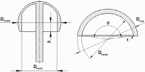 Figure 1. Design features of the hip resurfacing implants analyzed.